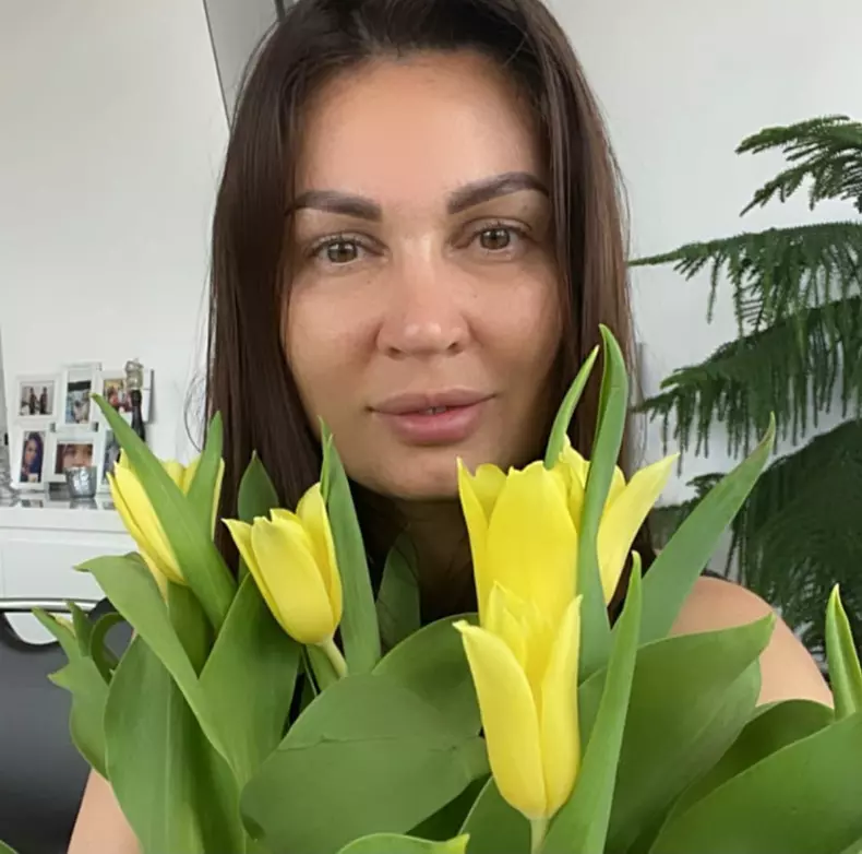 nicoleta luciu interventii estetice la fata (4)