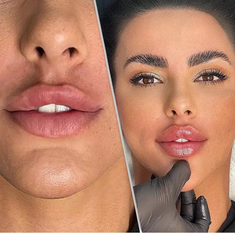 lavinia-parva-buze-marite