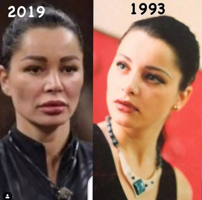 Brigitte-operatii-estetice-1