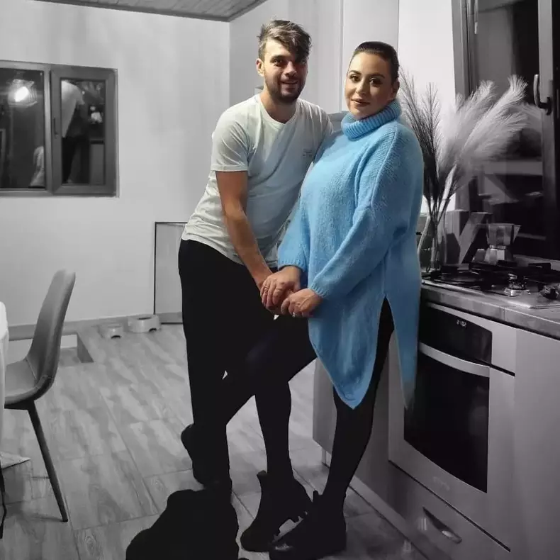 marius-elisei-alopecie-5