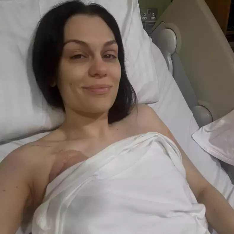 jessie-j-a-fost-operata-de-cancer-la-san-1-1