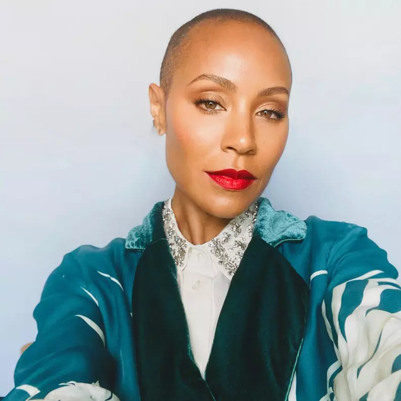 soția lui Will Smith Jada Pinkett Smith alopecia