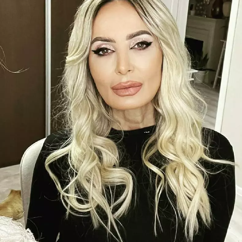 daniela gyorfi operatii estetice (3)