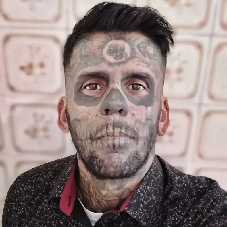 VIDEO: Former crook gets skull face tattoos removed after finding God
