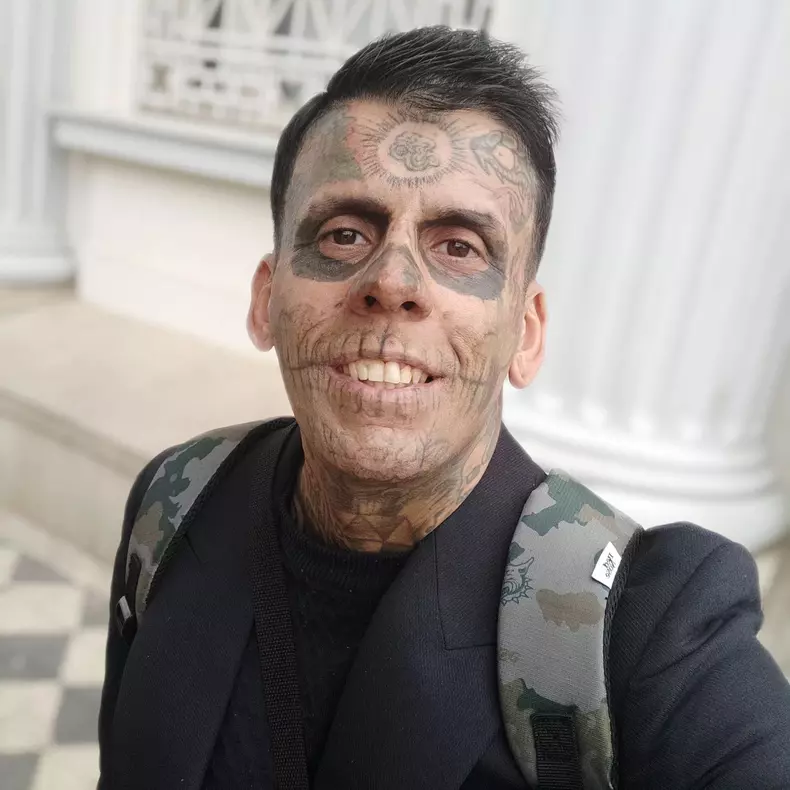 VIDEO: Former crook gets skull face tattoos removed after finding God