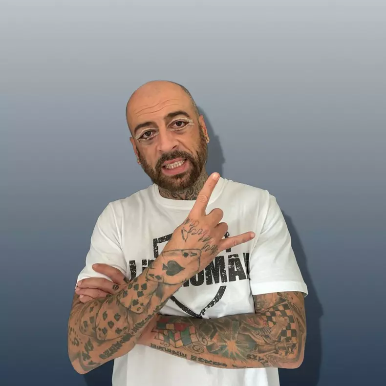 Cum arată CRBL după intervenția estetică  (2)