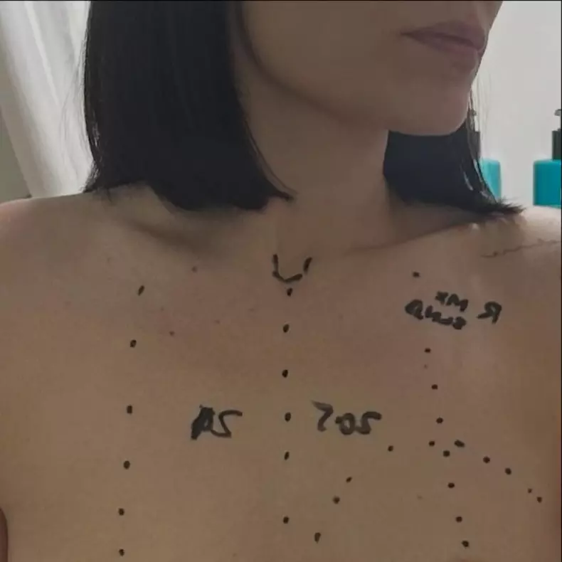 Jessie J a fost operată de cancer la sân (3)