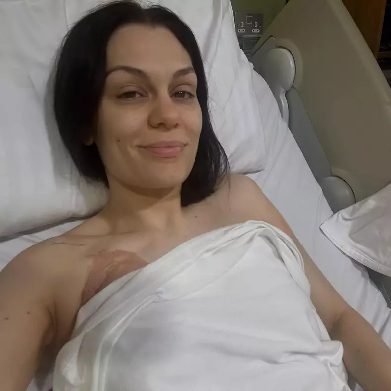 Jessie-J-cancer-la-san-operatie (1)