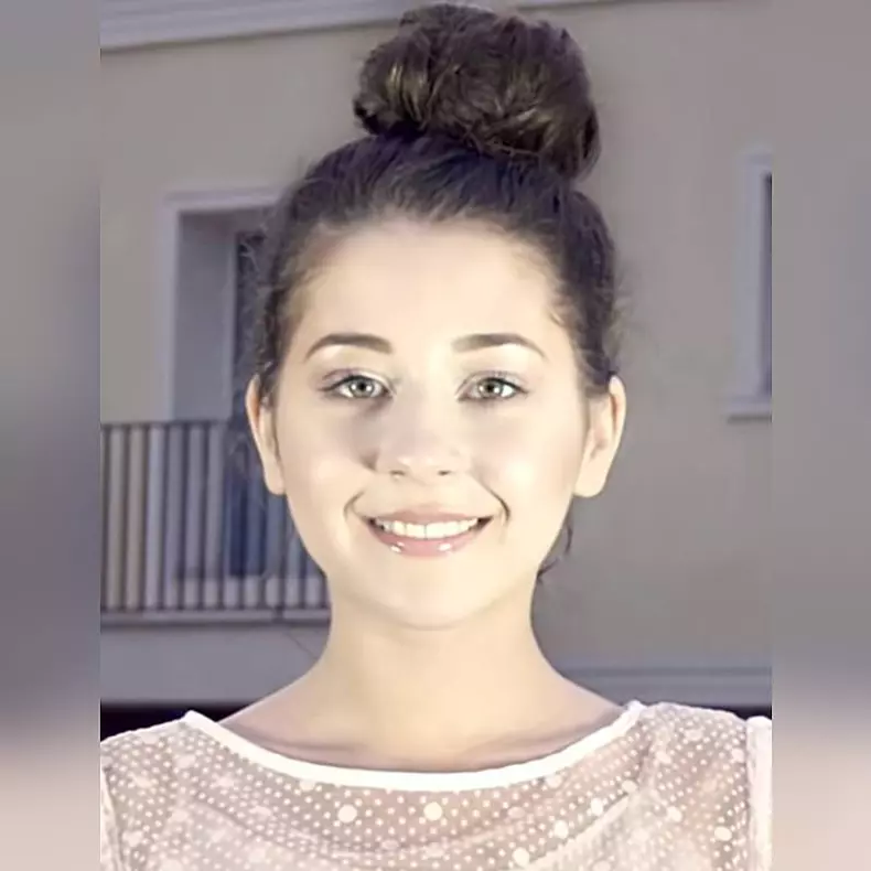 Nicole Cherry, despre operațiile estetice