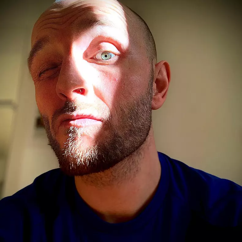 Catalin-Bordea-se-opereaza-9