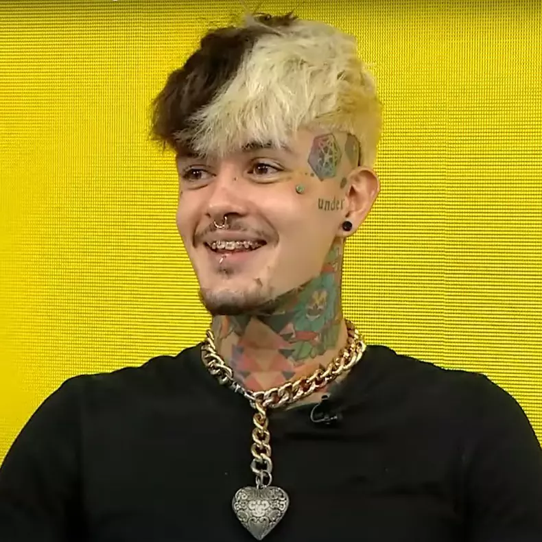 zanni-probleme-de-sanatate-dupa-survivor-8