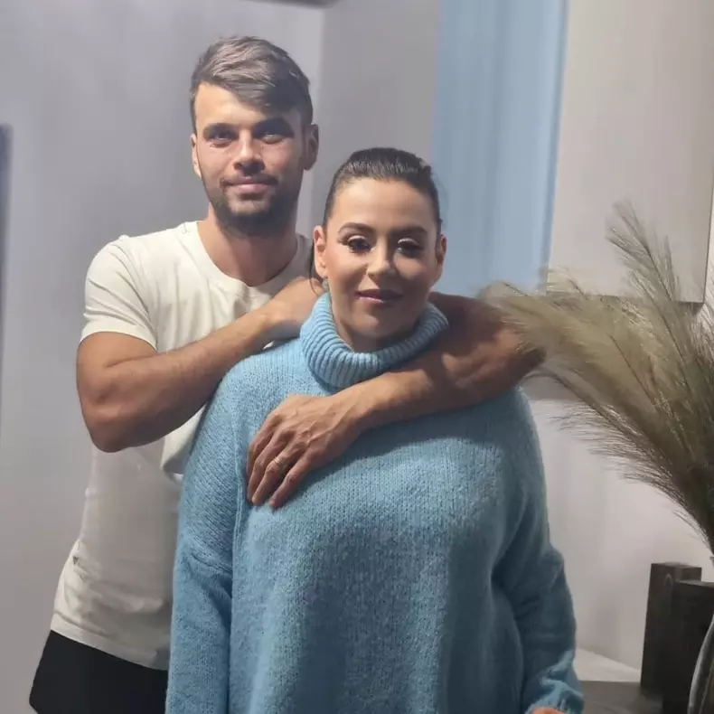 marius-elisei-alopecie-4