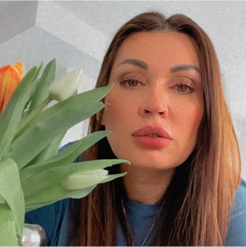 nicoleta luciu interventii estetice la fata (2)