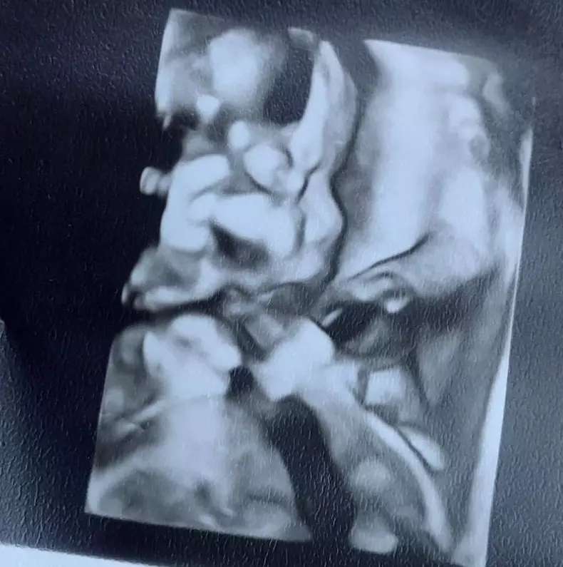 Larisa-Udilă-a-născut-3