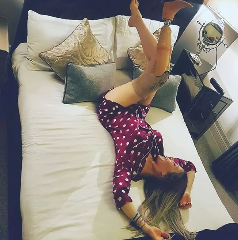 Stela Bizdu și-a pierdut piciorul în urma unui accident de mașină