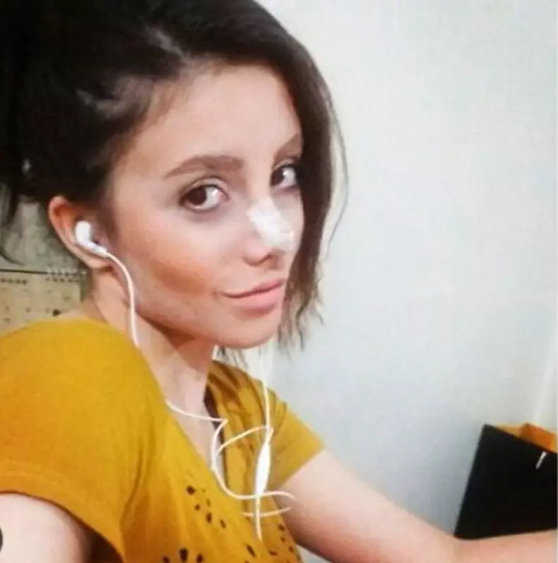 cum-arata-sahar-tabar-inainte-de-cele-50-de-operatii-estetice-10