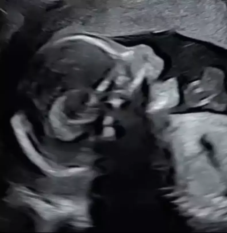 Laurențiu Reghecampf copil