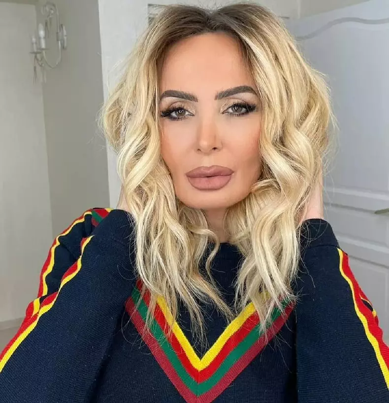 daniela gyorfi operatii estetice (2)