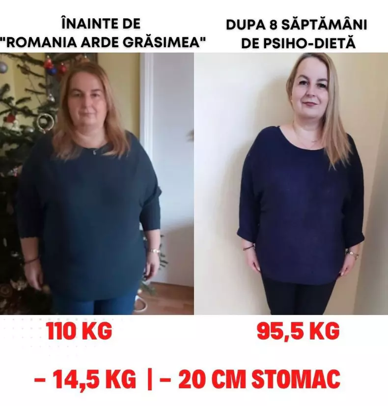 Anca Alungulesei psiho dieta grup