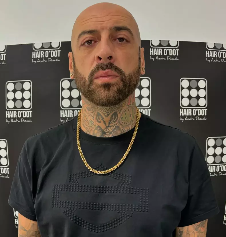 CRBL după intervenția estetică (3)