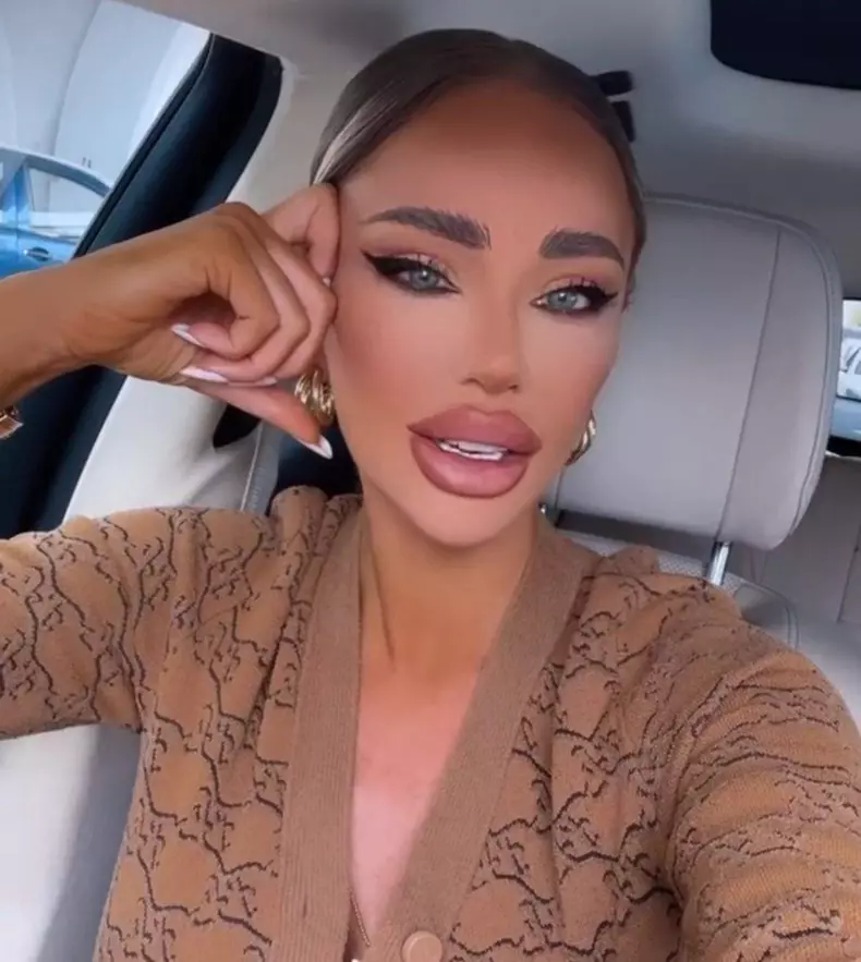 bianca dragusanu buze