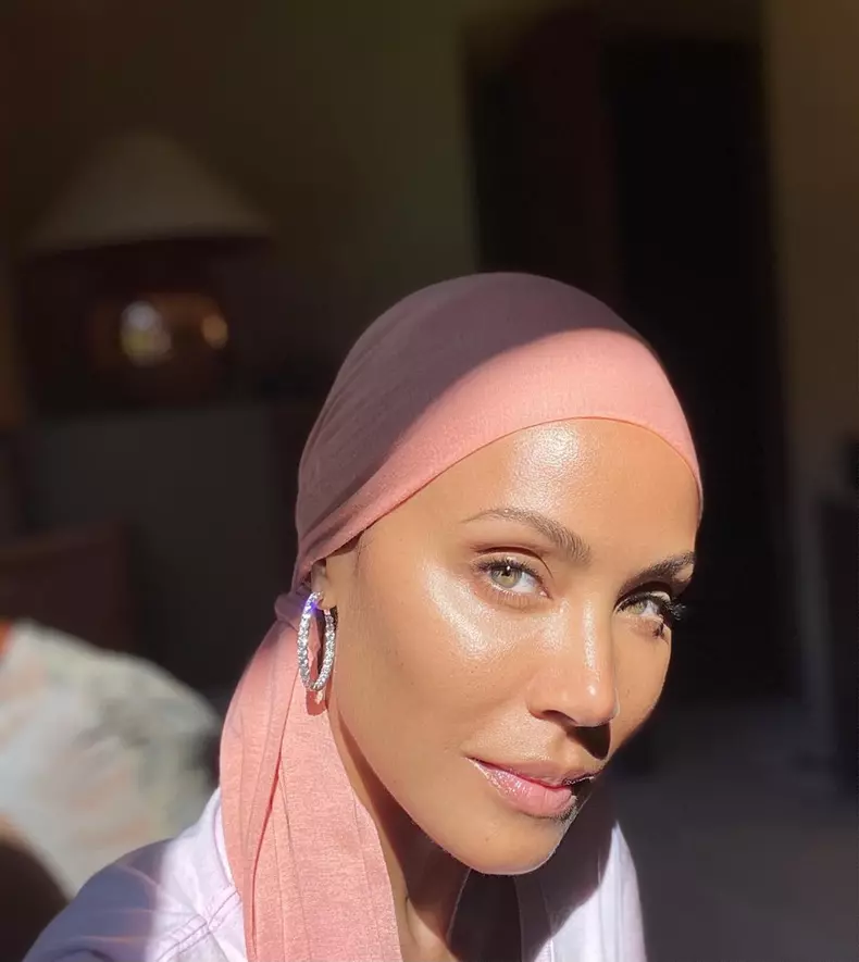 soția lui Will Smith Jada Pinkett Smith alopecia