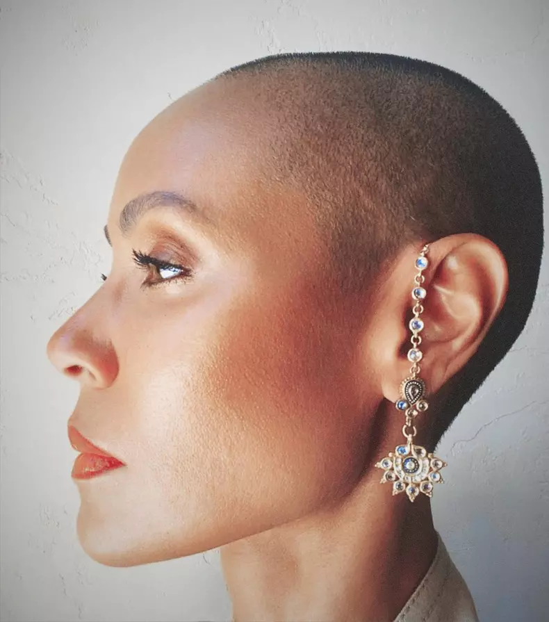 soția lui Will Smith Jada Pinkett Smith alopecia