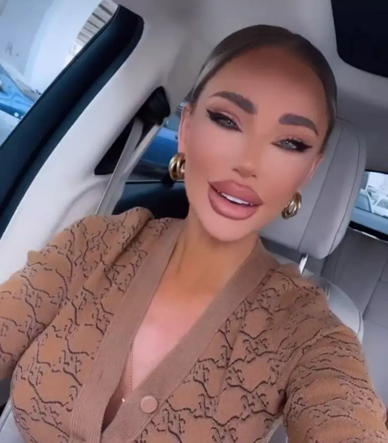 bianca a fost medicul estetician