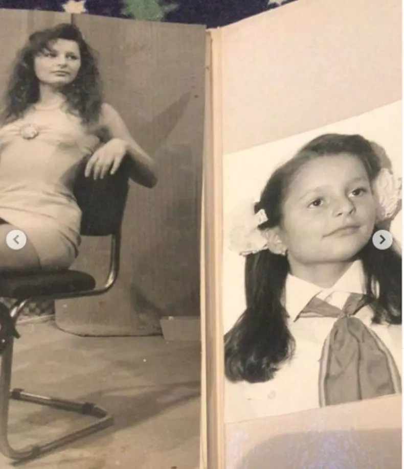 Brigitte-operatii-estetice3