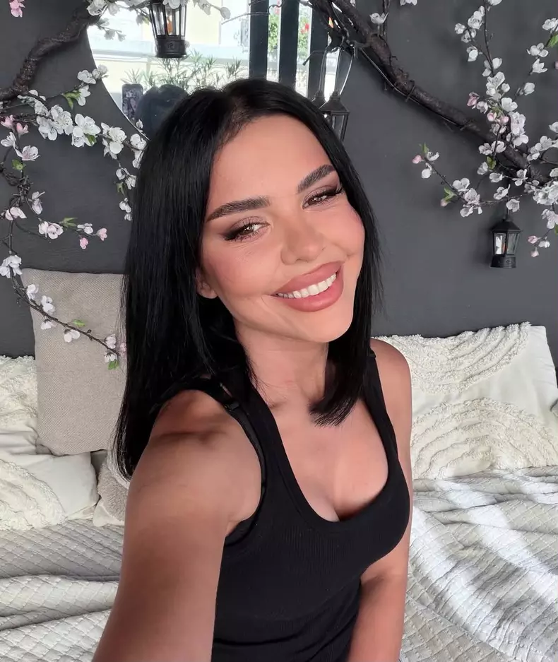 Andreea Popescu dupa operatiile estetice4
