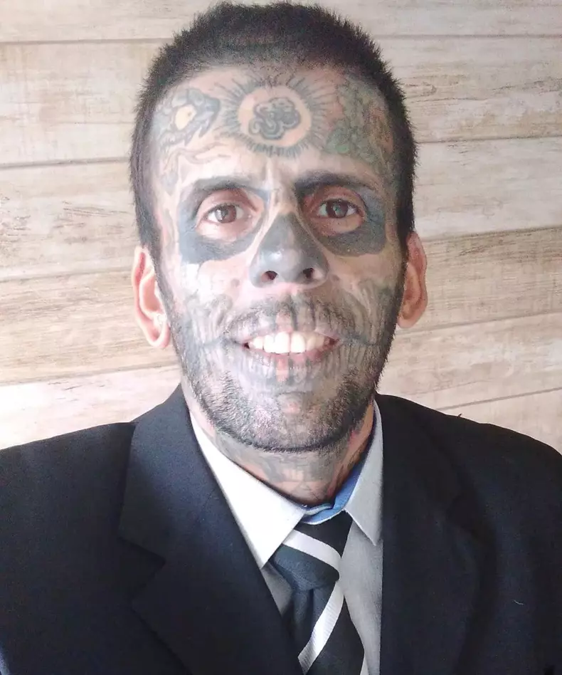 VIDEO: Former crook gets skull face tattoos removed after finding God