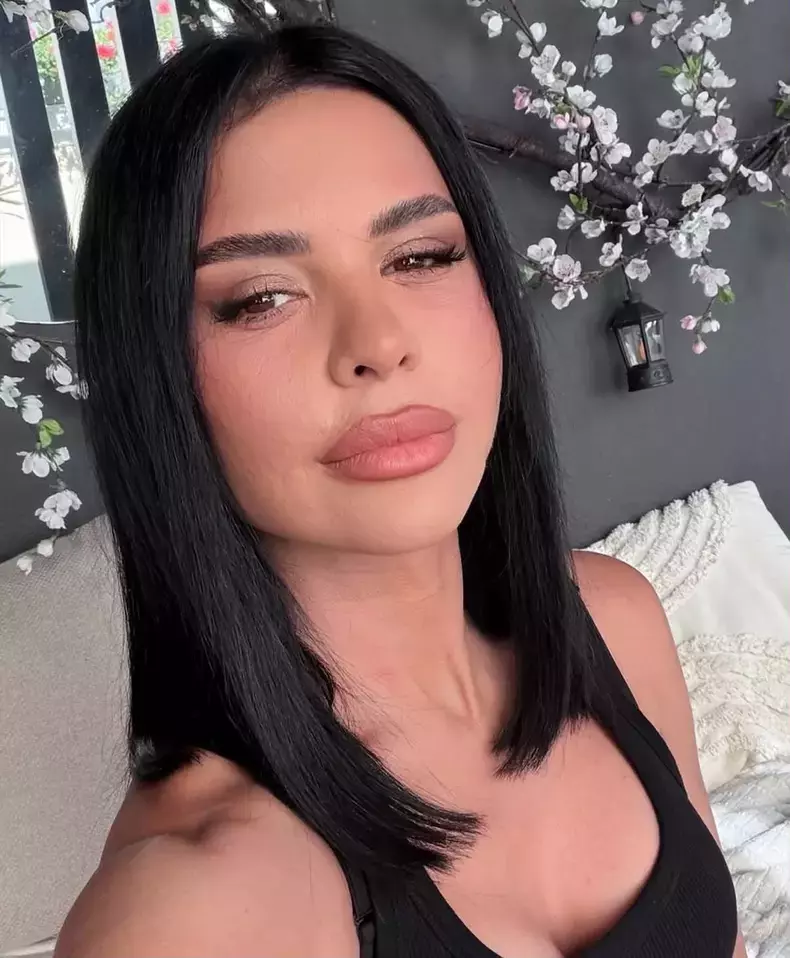 andreea-popescu-dupa-operatiile-estetice1