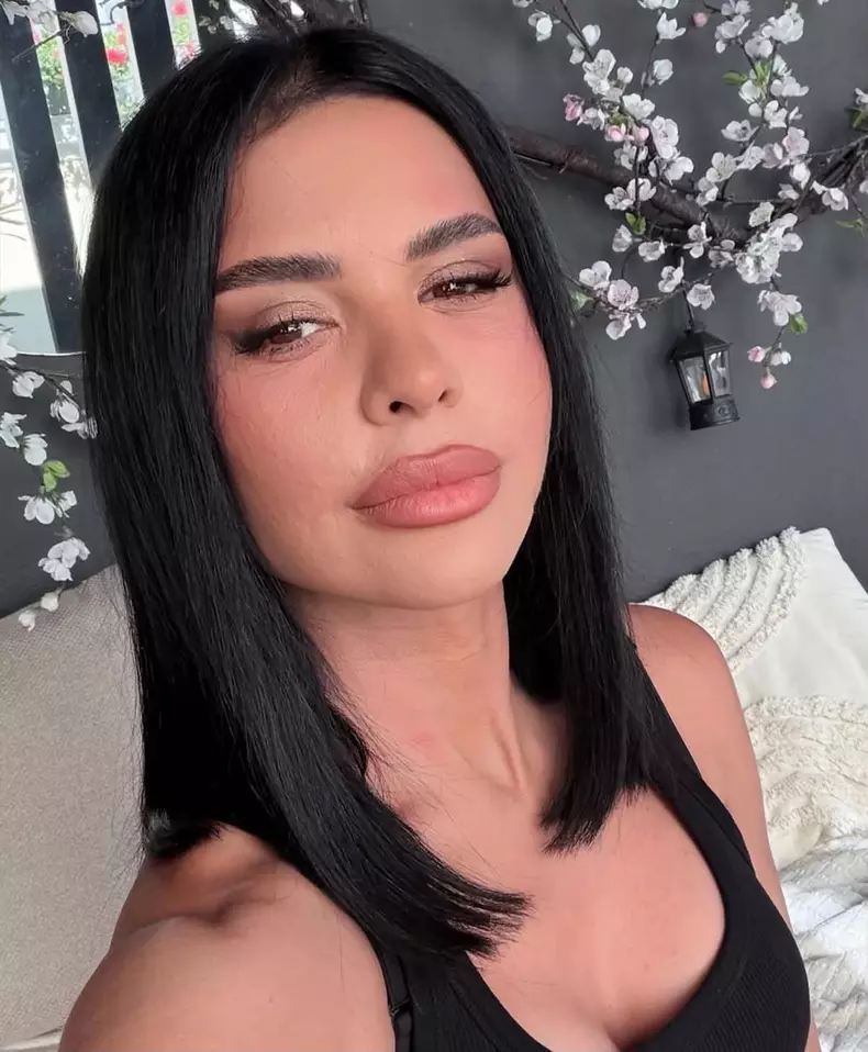 Andreea Popescu dupa operatiile estetice1