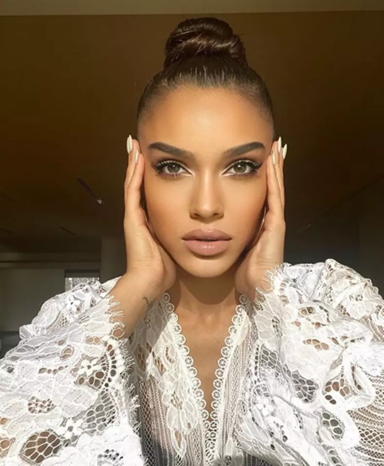 Karmen-prima-intervenție-estetică-1