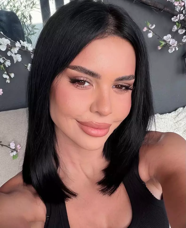 Andreea Popescu dupa operatiile estetice3