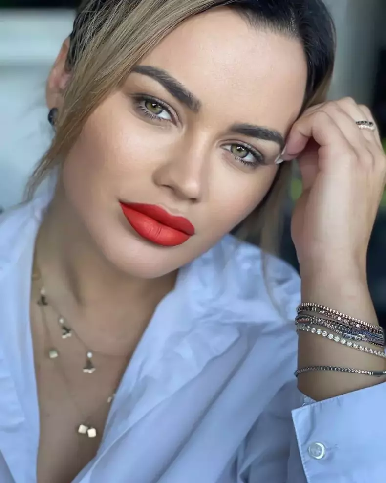 carmen-de-la-salciua-inselata-de-culita-sterp-4