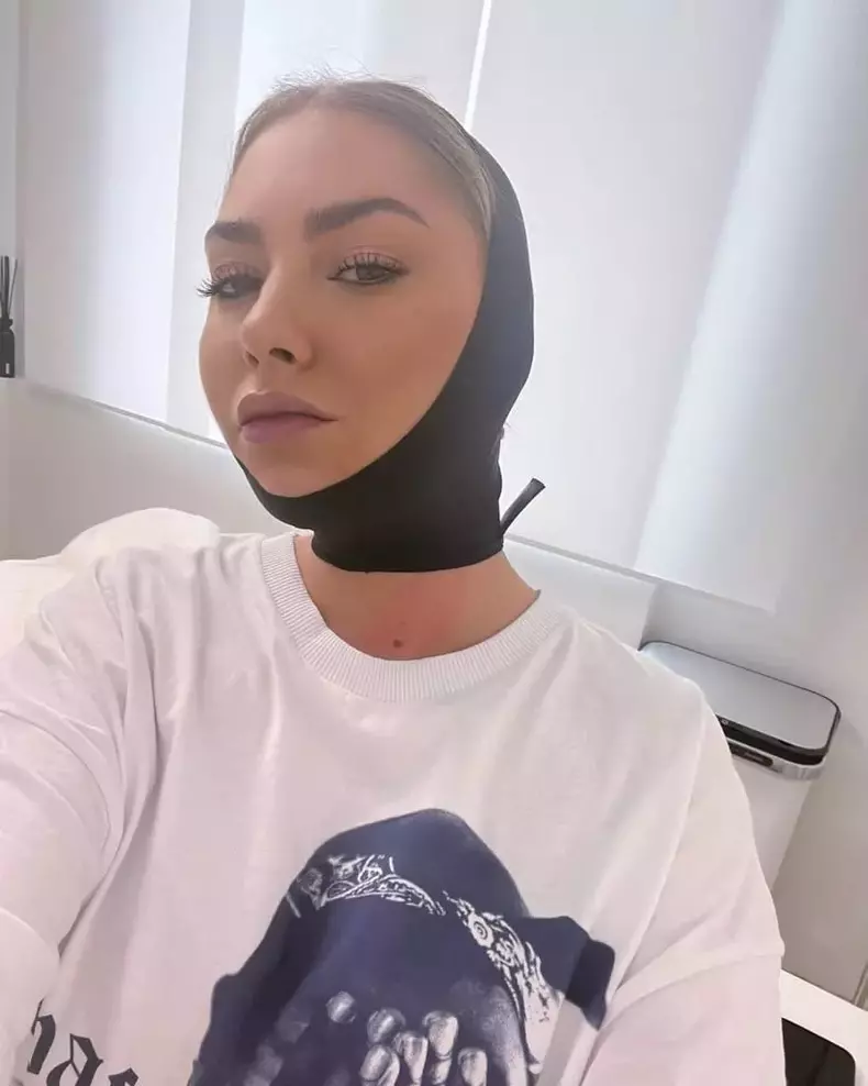 Ce operație estetică și-a făcut Jo „pentru sufletul ei”. Cum se recuperează acum artista