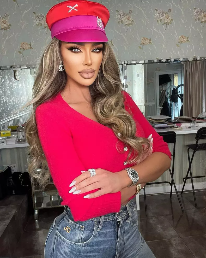 Bianca-Dragusanu-o-noua-interventie-estetica-3