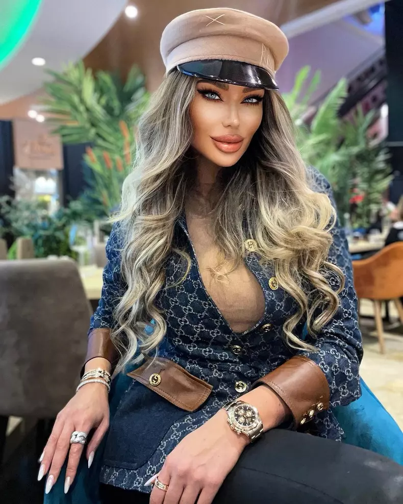 Bianca-Dragusanu-o-noua-interventie-estetica-7