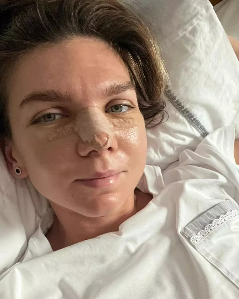 Simona Halep, primele imagini după operația la nas