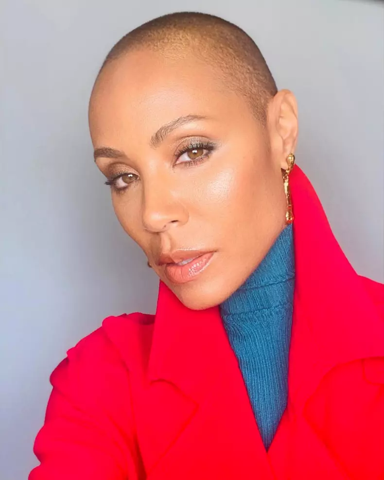 soția lui Will Smith Jada Pinkett Smith alopecia