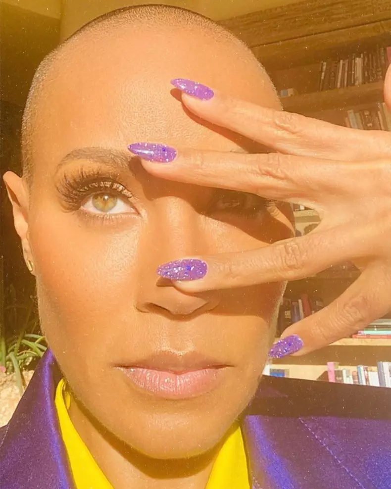 soția lui Will Smith Jada Pinkett Smith alopecia