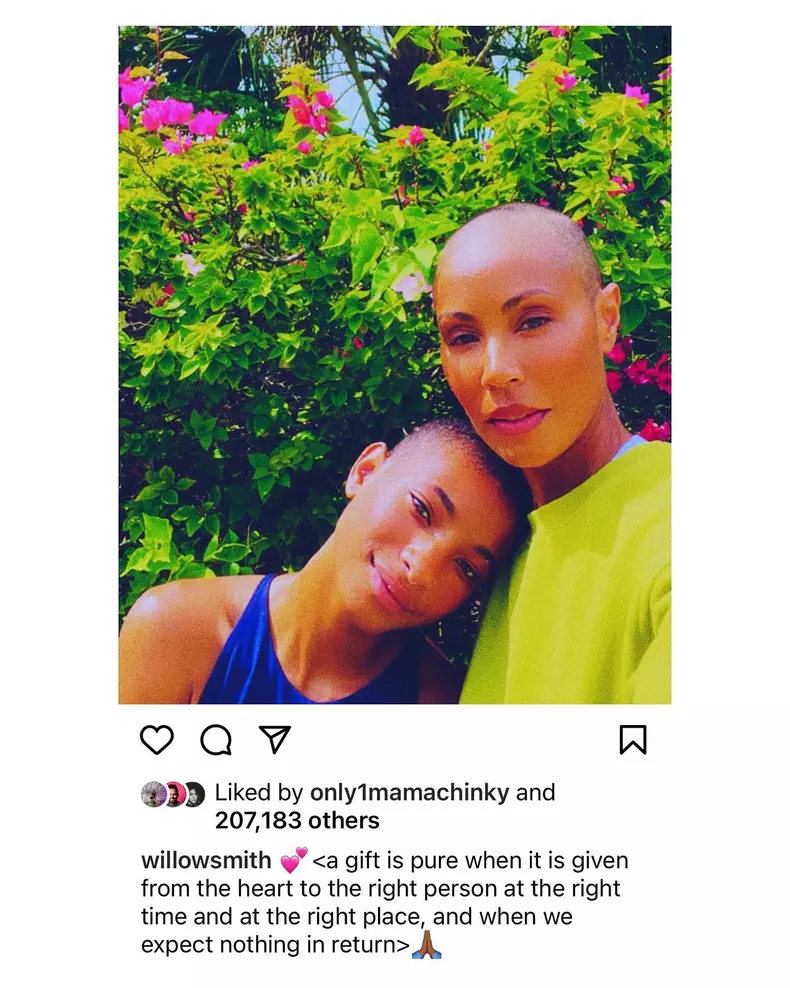soția lui Will Smith Jada Pinkett Smith alopecia