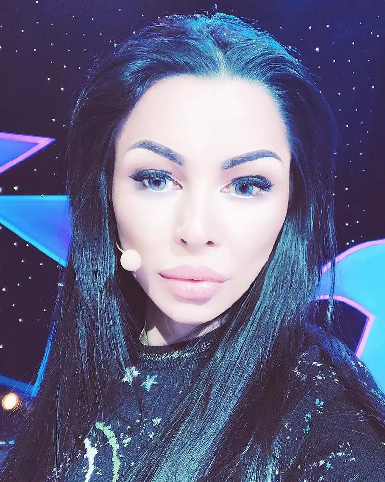 Brigitte Sfăt Pastramă operații estetice