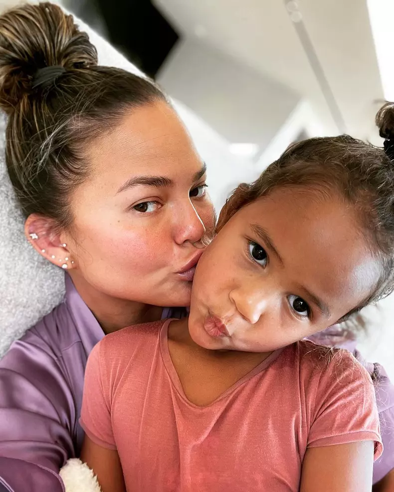 Chrissy-Teigen-de-nerecunoscut-dupa-o-operatie-estetica-Cum-arata-acum-sotia-lui-John-Legend-5
