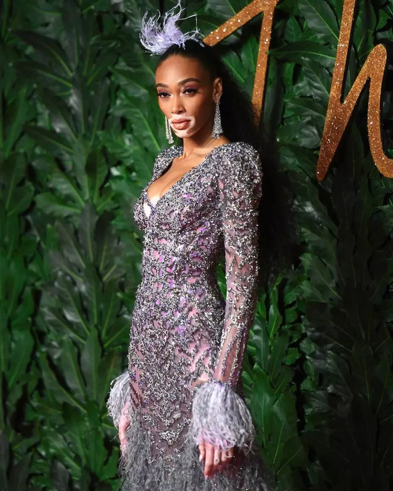 winnie-harlow-6