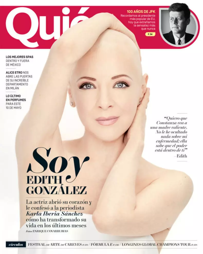 edith-gonzalez-sin-peluca-cancer-fotos-1