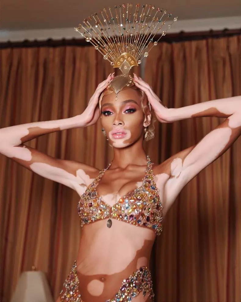 Winnie-Harlow-@winnieharlow-819x1024