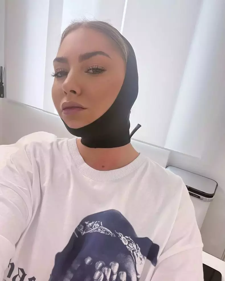 Ce operație estetică și-a făcut Jo „pentru sufletul ei”. Cum se recuperează acum artista