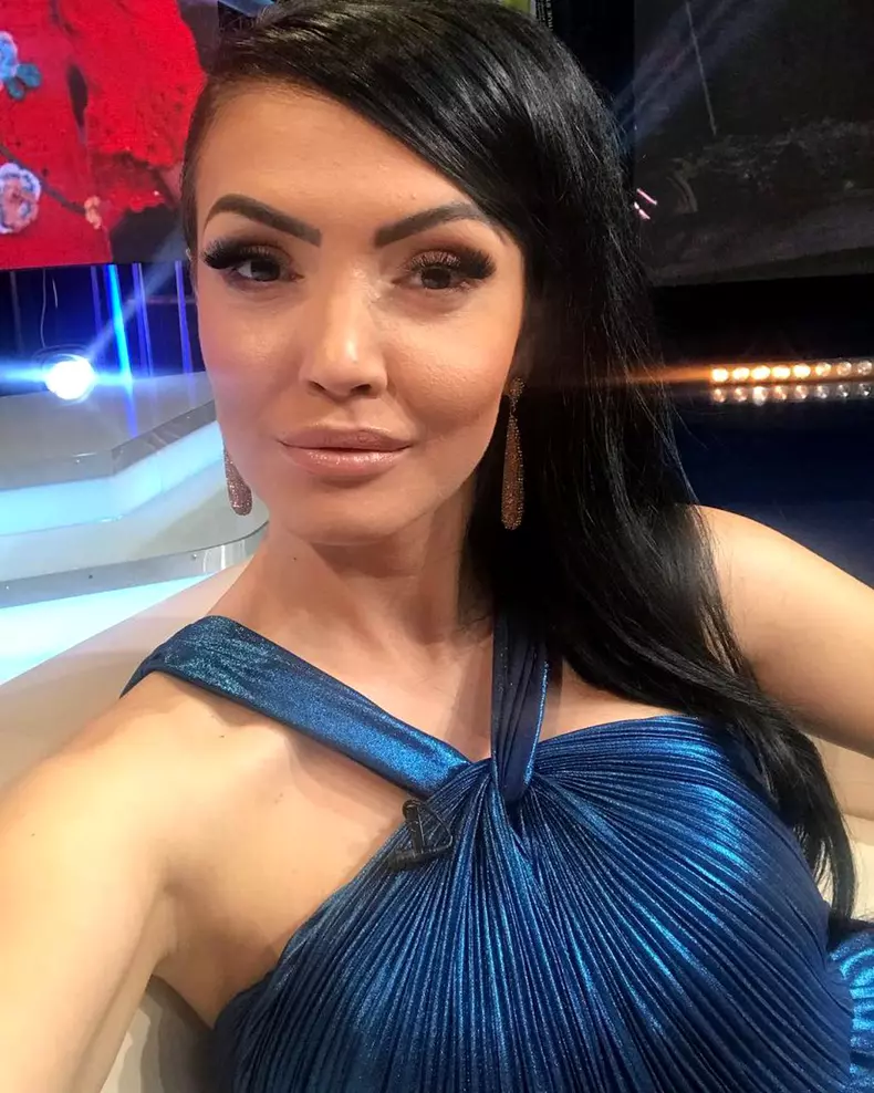 Andreea Mantea are probleme mari cu acneea, pe care o ascunde cu machiaj